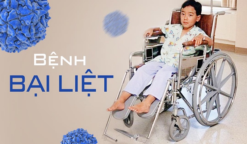 Tiêm chủng đầy đủ - Biện pháp hiệu quả phòng bệnh bại liệt 
